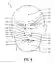 Fig. 04 - Customized sealing member from blank