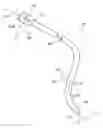 Fig. 01 - Electrode catheters and methods for making them