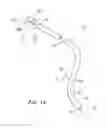 Fig. 02 - Electrode catheters and methods for making them