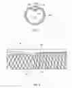 Fig. 08 - Electrode catheters and methods for making them
