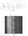 Fig. 09 - Electrode catheters and methods for making them