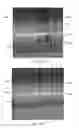 Fig. 10 - Electrode catheters and methods for making them