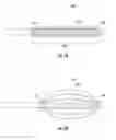 Fig. 06 - APPARATUS AND METHOD FOR PROMOTING ANGIOGENESIS IN ISCHEMIC TISSUE