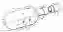 Fig. 01 - Introducer for lumen support or dilation