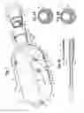 Fig. 02 - Introducer for lumen support or dilation