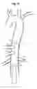 Fig. 05 - Introducer for lumen support or dilation