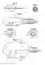 Fig. 03 - BALLOON AND MESH FOR LUMEN SUPPORT OR DILATION