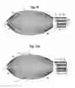 Fig. 08 - BALLOON AND MESH FOR LUMEN SUPPORT OR DILATION