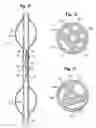 Fig. 06 - OFFSET BALLOONS FOR LUMEN SUPPORT OR DILATION
