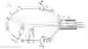 Fig. 01 - DUAL BALLOON FOR LUMEN SUPPORT OR DILATION