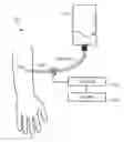 Fig. 01 - System and method for detecting air embolisms in lines for hemodynamic monitoring