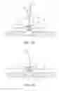 Fig. 06 - High frequency stimulation of the spinal cord from inside the dura