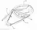 Fig. 01 - Resistance kickboard attachment