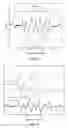 Fig. 15 - Diphasic gas/liquid plasma reactor