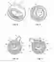 Fig. 04 - Pump actuator head