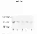 Fig. 18 - Methods for treating diseases related to mitochondrial stress