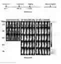 Fig. 16 - Methods and compositions for chimeric antigen receptor targeting cancer cells