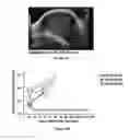 Fig. 17 - Methods and compositions for chimeric antigen receptor targeting cancer cells