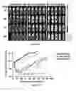 Fig. 18 - Methods and compositions for chimeric antigen receptor targeting cancer cells