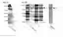 Fig. 06 - Modulating the alternative complement pathway