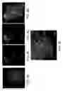 Fig. 09 - Methods of generating tissue using devitalized, acellular scaffold matrices derived from micro-organs