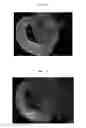 Fig. 02 - Method for producing ciliary marginal zone-like structure