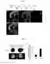 Fig. 07 - Method for producing ciliary marginal zone-like structure