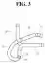 Fig. 04 - Clip for injector
