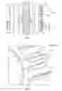 Fig. 04 - Reduction of cavitation in gear pumps