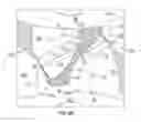 Fig. 06 - Reduction of cavitation in gear pumps