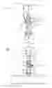 Fig. 03 - Pipeline insertion apparatus and method