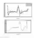 Fig. 22 - Electrochemical detection of nitro-containing compounds