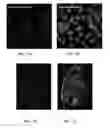Fig. 14 - COMPOSITIONS FOR MULTIPLEX IMAGING USING LABELED NUCLEIC ACID IMAGING AGENTS