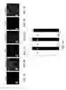 Fig. 16 - COMPOSITIONS FOR MULTIPLEX IMAGING USING LABELED NUCLEIC ACID IMAGING AGENTS