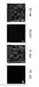 Fig. 17 - COMPOSITIONS FOR MULTIPLEX IMAGING USING LABELED NUCLEIC ACID IMAGING AGENTS