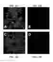 Fig. 20 - COMPOSITIONS FOR MULTIPLEX IMAGING USING LABELED NUCLEIC ACID IMAGING AGENTS