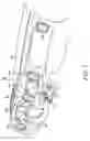 Fig. 02 - Lens system and method