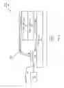 Fig. 03 - Reducing connections from a sensing module