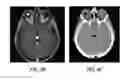 Fig. 06 - Image quality in cone beam computed tomography images using deep convolutional neural networks