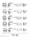 Fig. 35 - METHODS AND SYSTEMS FOR PRODUCING AN IMPLANT