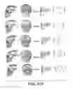 Fig. 49 - METHODS AND SYSTEMS FOR PRODUCING AN IMPLANT