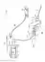 Fig. 02 - Surgical instrument with phase change cooling