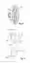 Fig. 09 - SUPPORT ELEMENT, IN PARTICULAR STATOR SUPPORT ELEMENT AND/OR ROTOR SUPPORT ELEMENT, SYSTEM OF SUPPORT ELEMENTS, GENERATOR SUPPORT, GENERATOR, GENERATOR SUPPORT SYSTEM, NACELLE OF A WIND TURBINE, WIND TURBINE AND METHOD FOR ASSEMBLING A GENERATOR SUPPORT SYSTEM