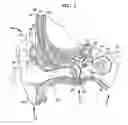 Fig. 02 - BONE CONDUCTION DEVICE FITTING