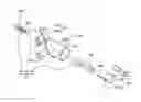 Fig. 01 - Implantable microphone for an implantable ear prosthesis