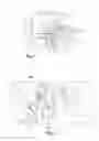 Fig. 02 - Implantable microphone for an implantable ear prosthesis