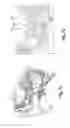 Fig. 06 - Implantable microphone for an implantable ear prosthesis