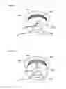 Fig. 06 - Cooking vessel sensor and induction heating device including a cooking vessel sensor