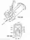 Fig. 65 - Safety blood collection assembly with indicator