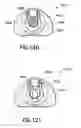 Fig. 76 - Safety blood collection assembly with indicator